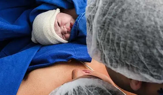 Czy cesarka to operacja? Poznaj prawdę o cesarskim cięciu