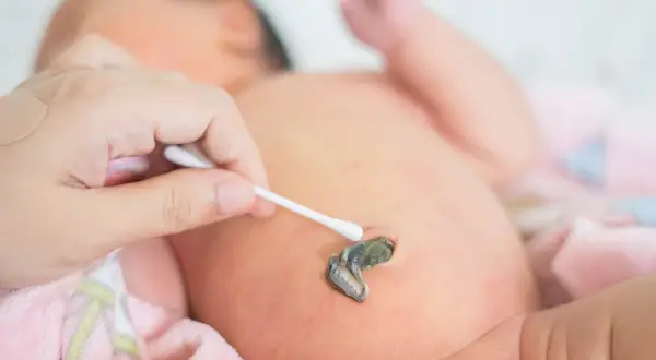 Delikatna pielęgnacja pępowiny noworodka. Dłoń z patyczkiem kosmetycznym czyści pozostałość po pępowinie.